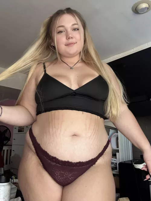 Are all the stretch marks a turn off by lxves_