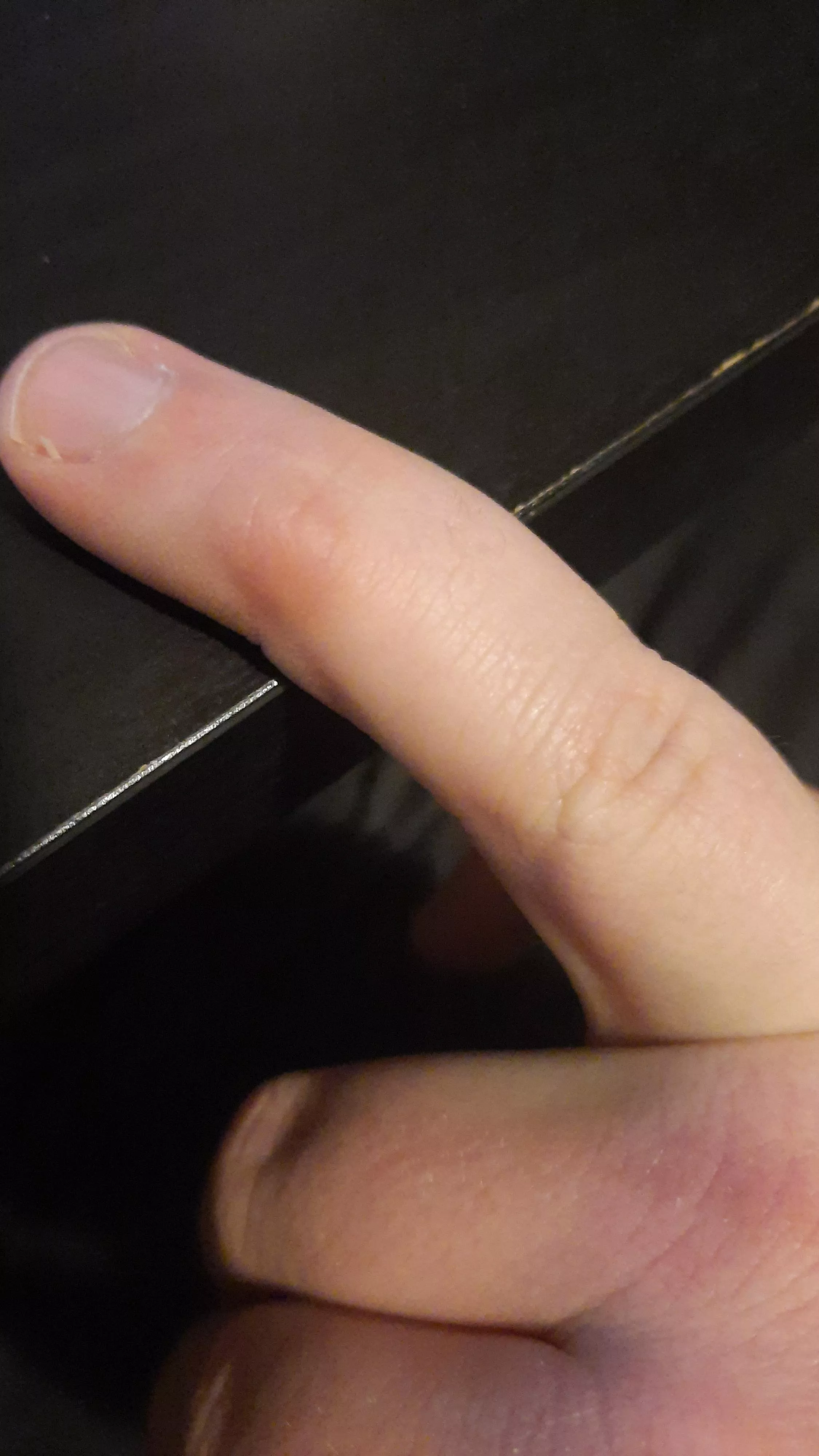 2 decade old blister posted by Stammertime01