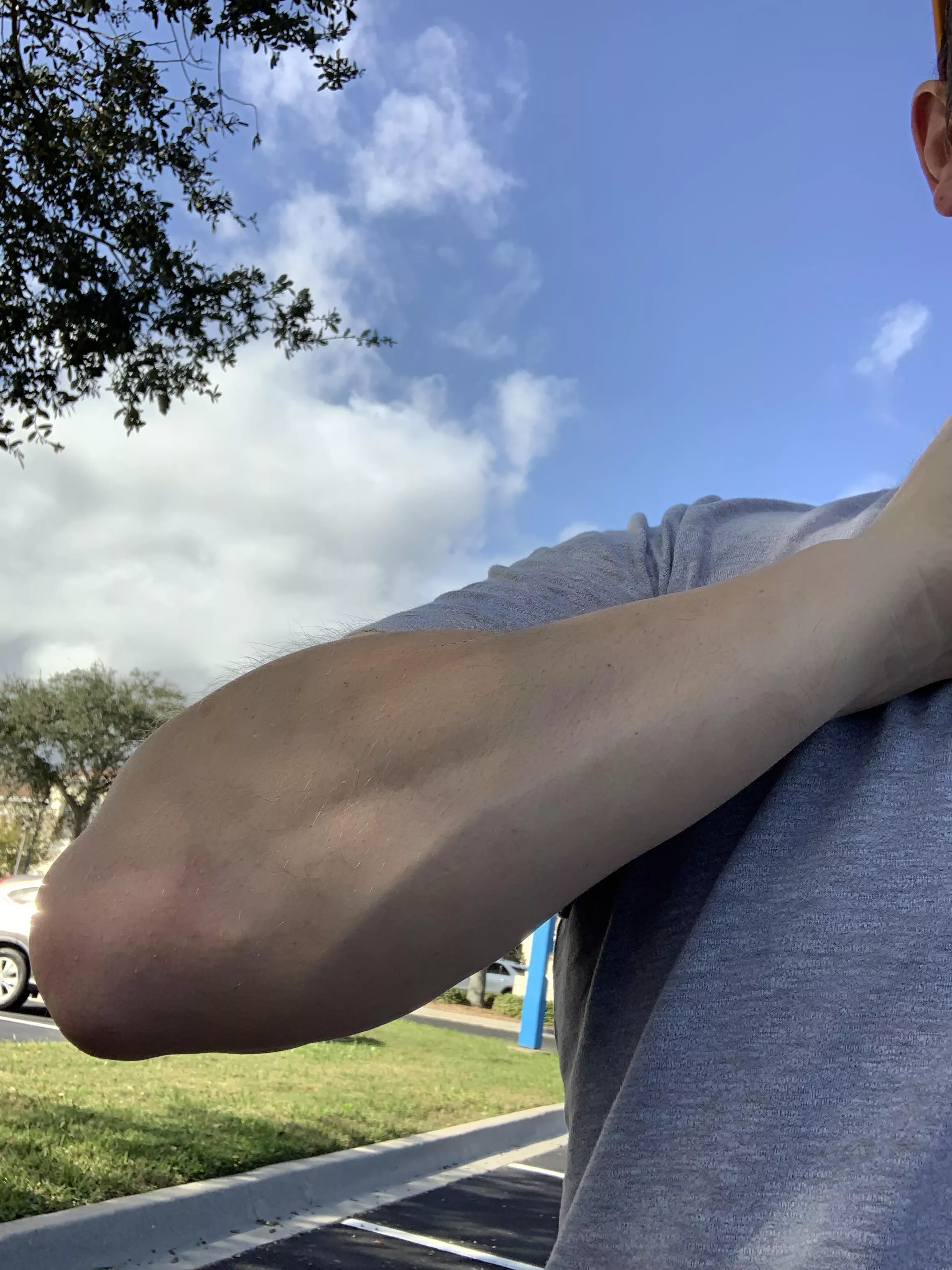 My Post Workout Forearm posted by Archers_heart