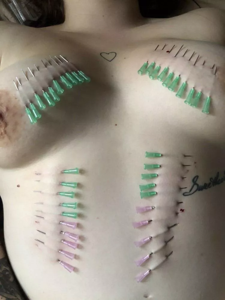 Pokey pain slut posted by antique-teeth