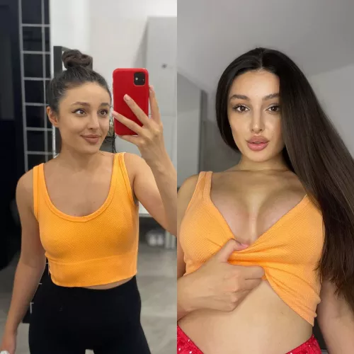 The more I look at my progress, the more surgeries I want by Emilia-Movie-Lover