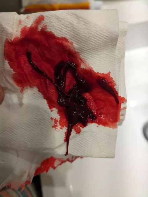 Dopeass clot (so blood, obvs) by Ready-Guidance4145