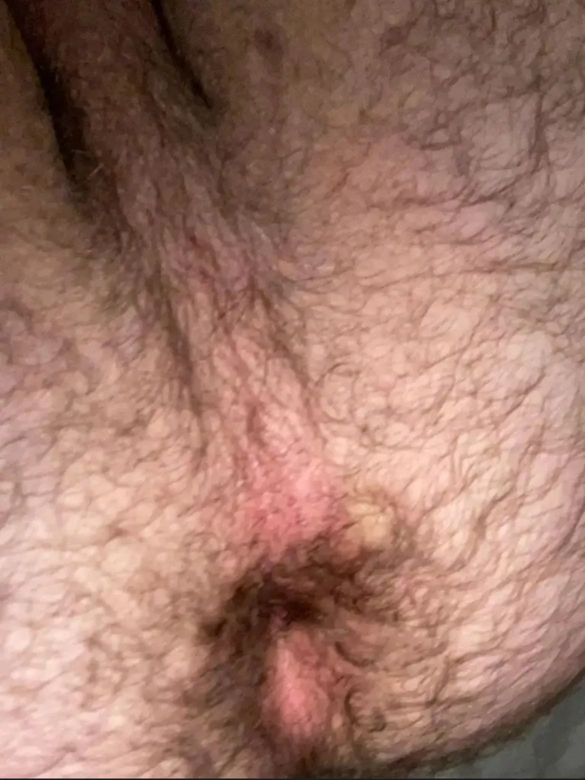 Is my hole to hairy? posted by YogurtNo5506