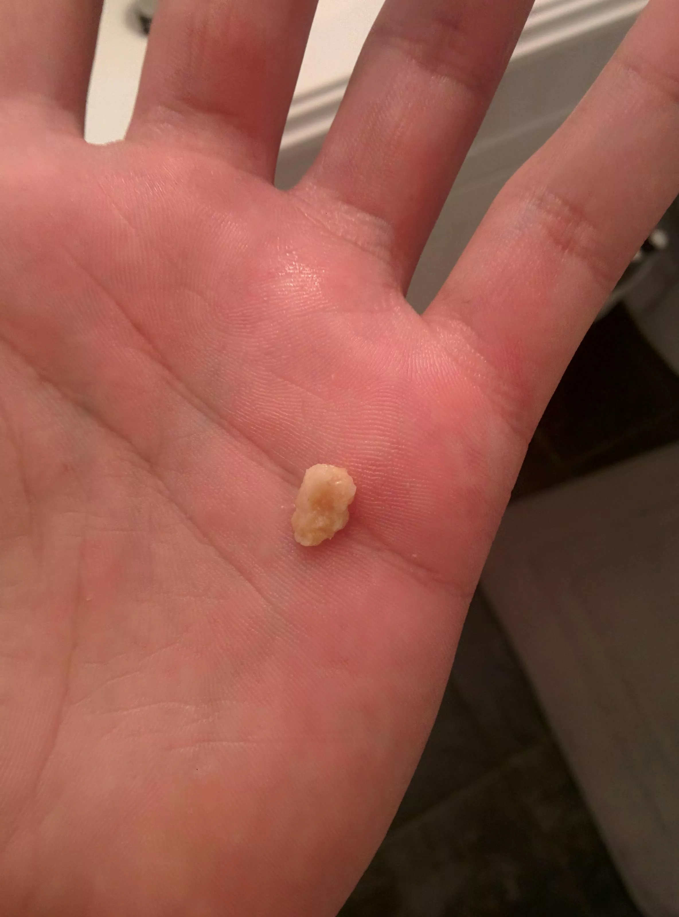 My absolute MONSTER tonsil stone that just came out 🤢 posted by FiteMeIRLm8