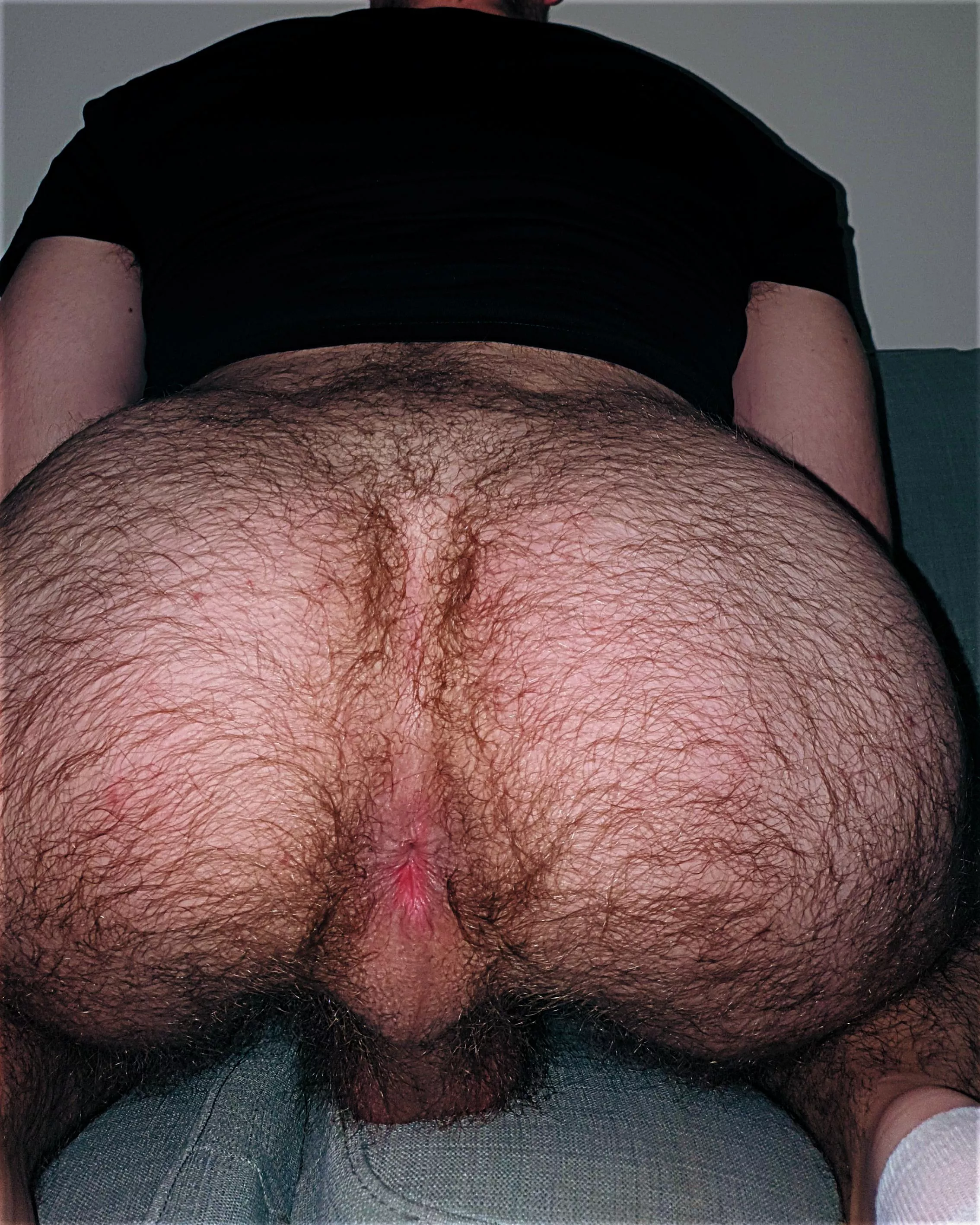 Should I embrace my hairy ass? posted by Separate_Fly6315