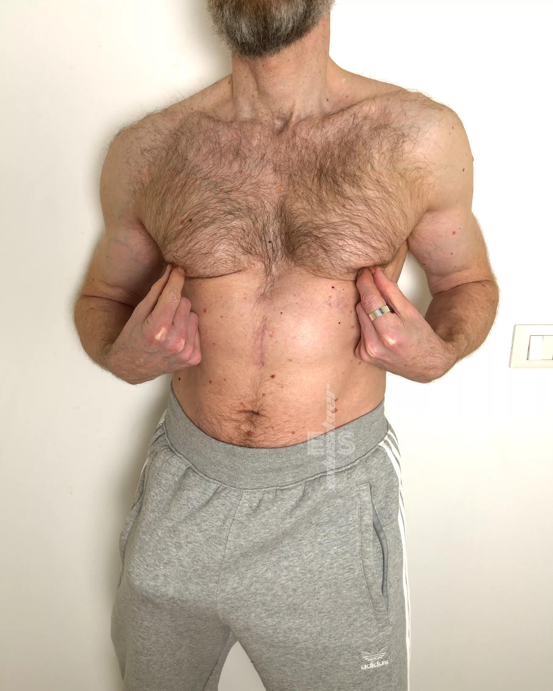 Oops! Is this what you would call a wardrobe malfunction? posted by EdoSilverXXX