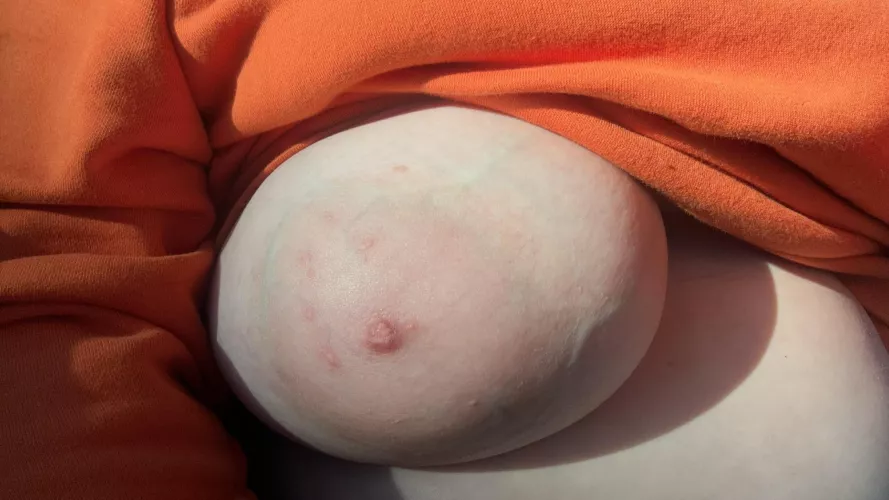 She needed a little sunlight by Large_Badger8317