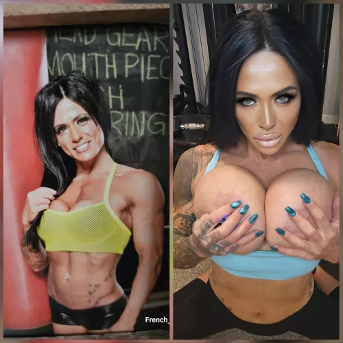 Transformation 375cc to 1250cc lip filler, cheeks and jaw. by French_Fantasy