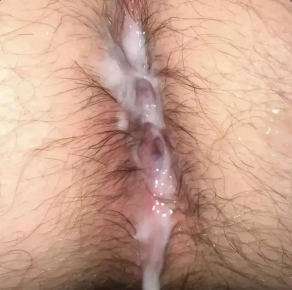 30 etx posted by Fun-Raspberry-3009