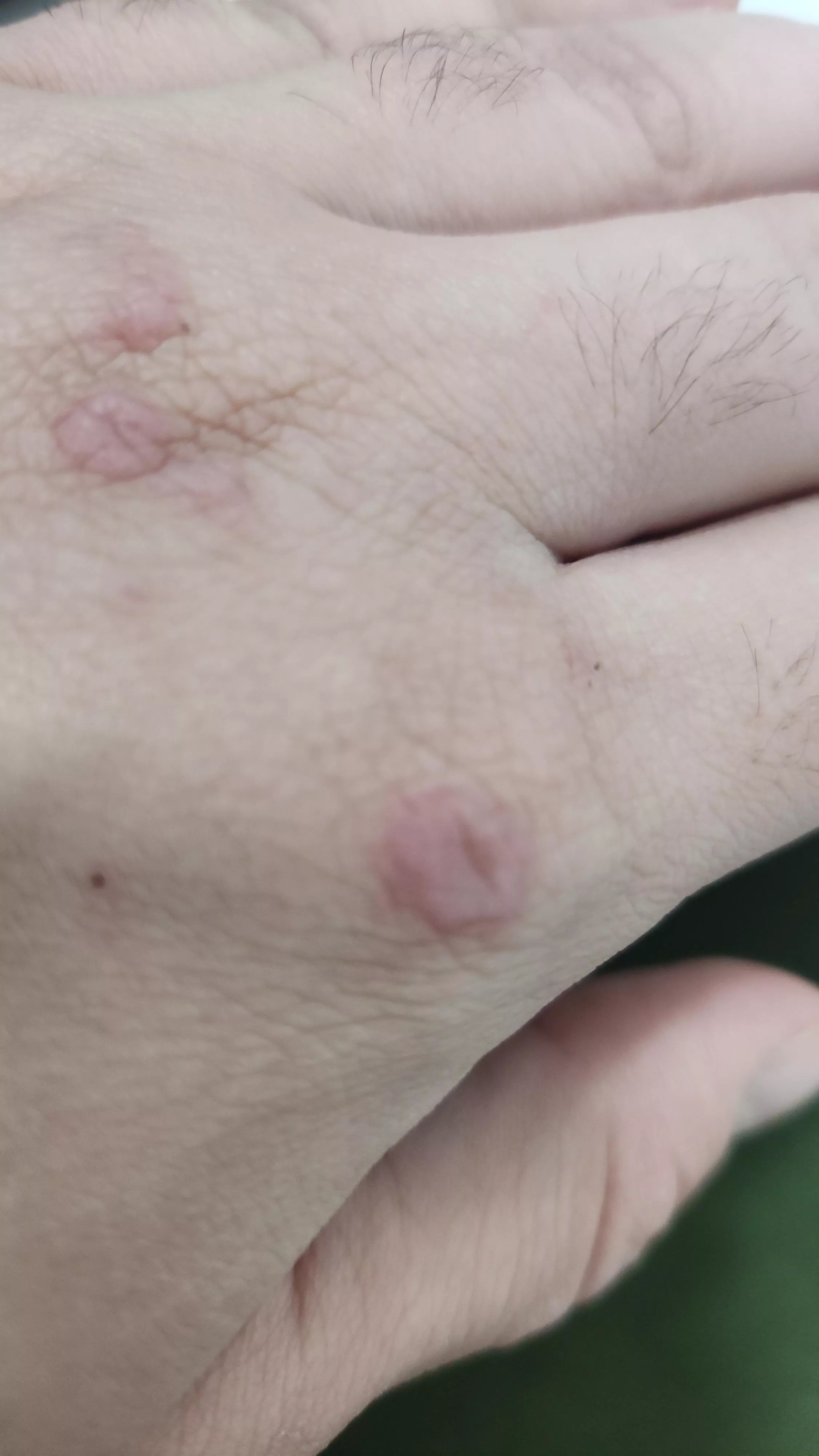 Anyone know what this could be posted by That_Energy6027