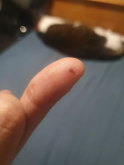 Bit by my cat a couple days ago by First-Catch1528