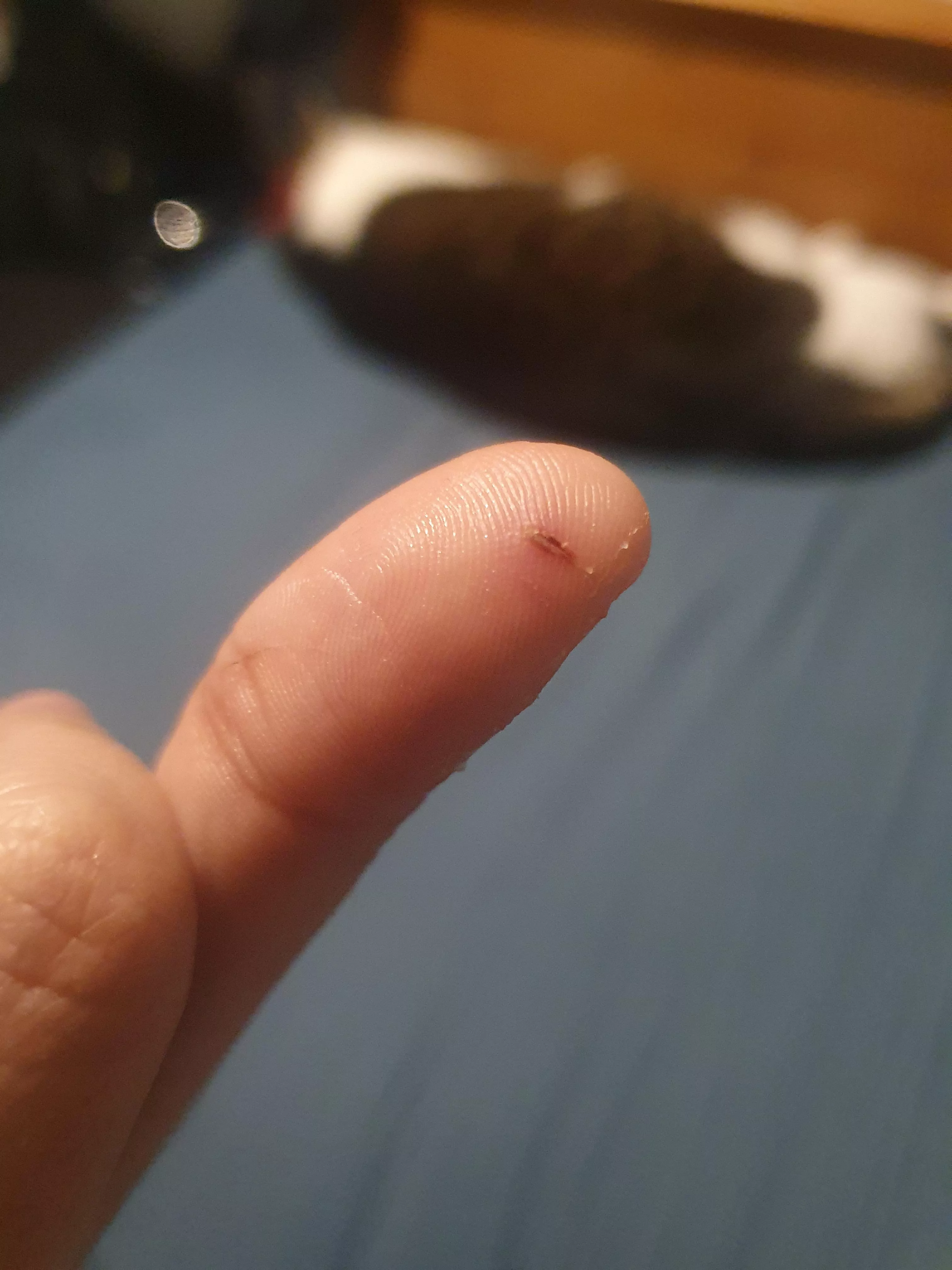 Bit by my cat a couple days ago posted by First-Catch1528