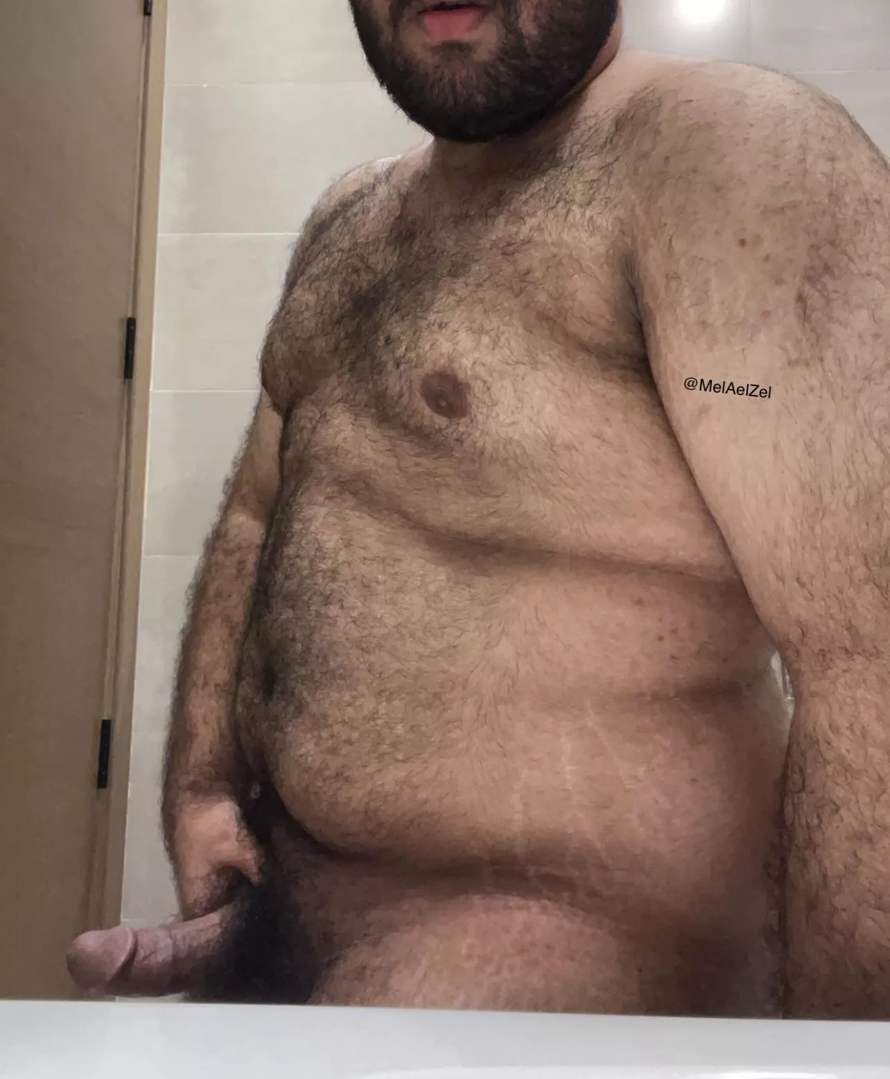 (21) are my stretch marks unattractive? posted by MelAelZel