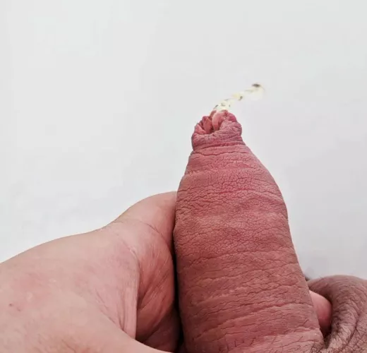 Chilly pee by This-Aint-A-scen3