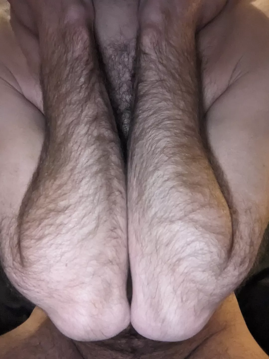 Hairy and skinny posted by Yugoogli