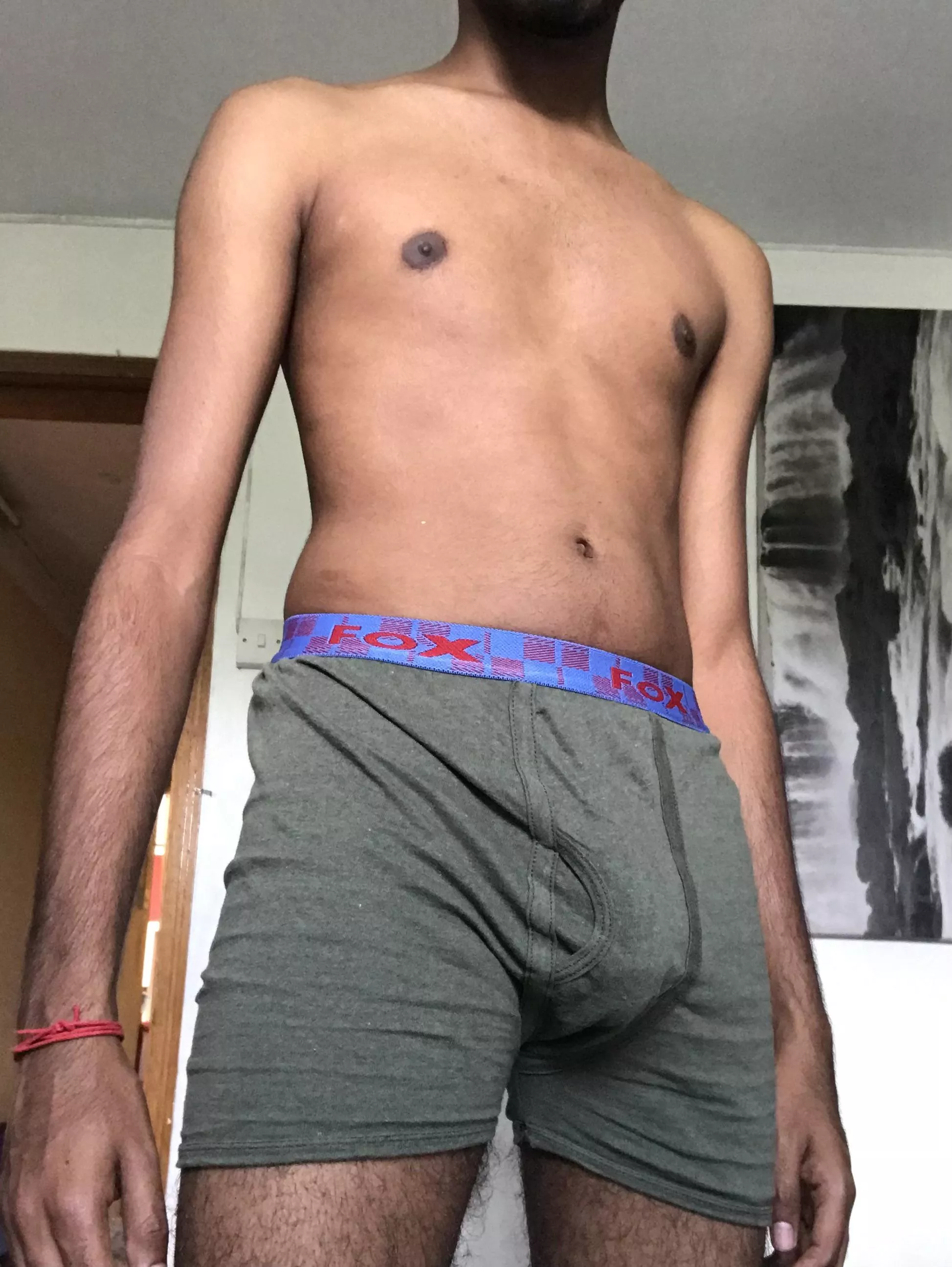 Is it okay to walk around like that? posted by iSincerelyFugly