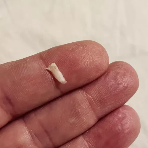 Popped out the extra sliver of toenail tonight by momthom427