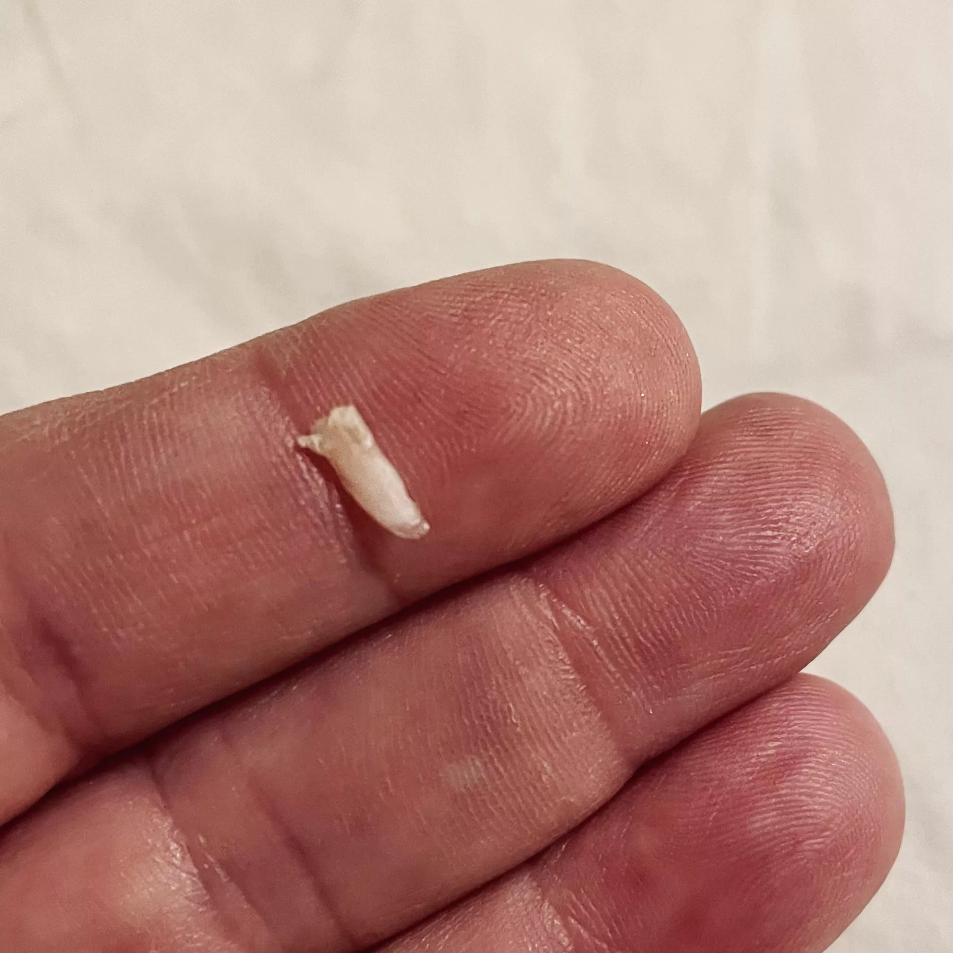 Popped out the extra sliver of toenail tonight posted by momthom427