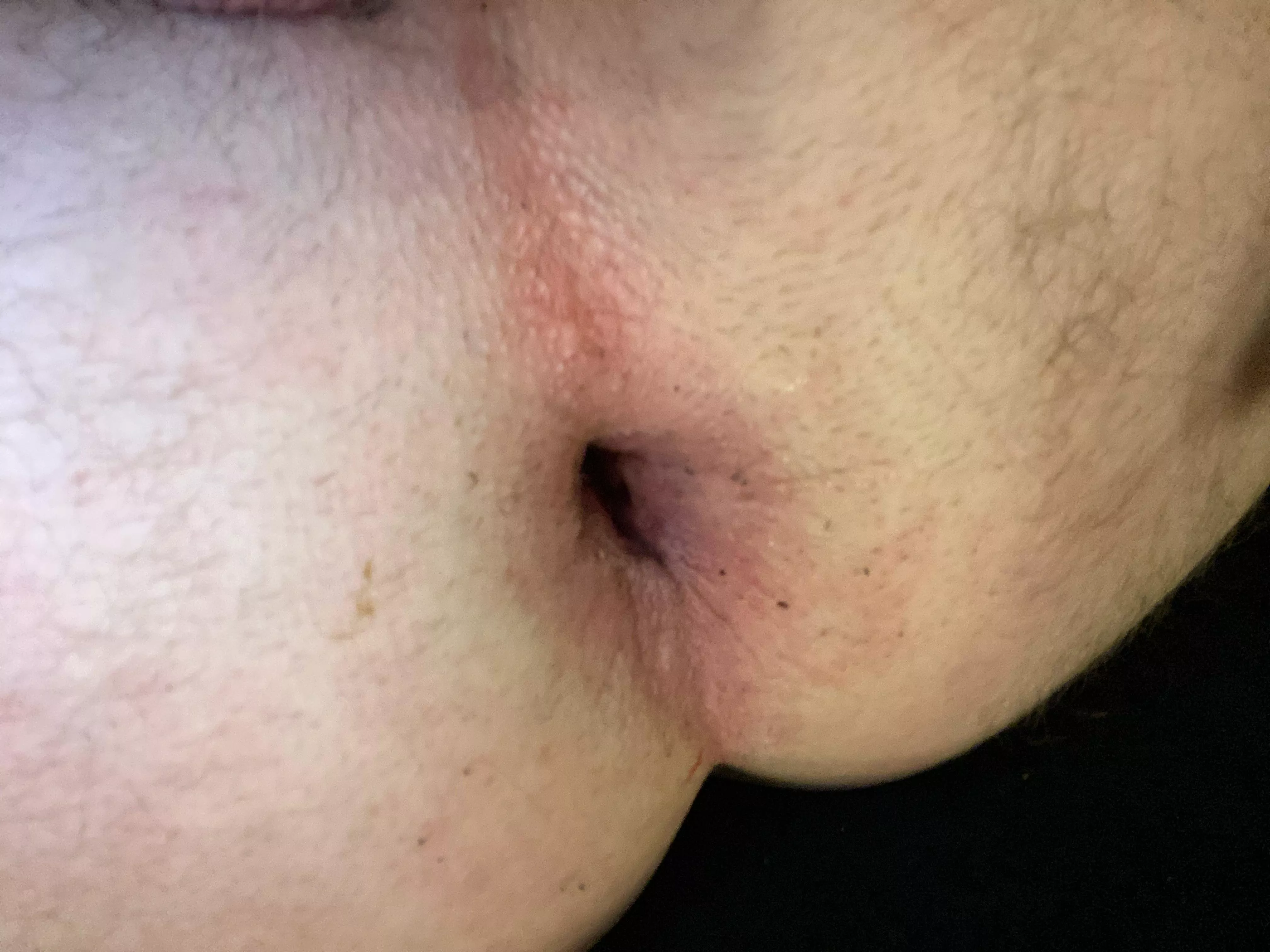 Think you can gape me more pop up 😘 posted by No_Albatross8841