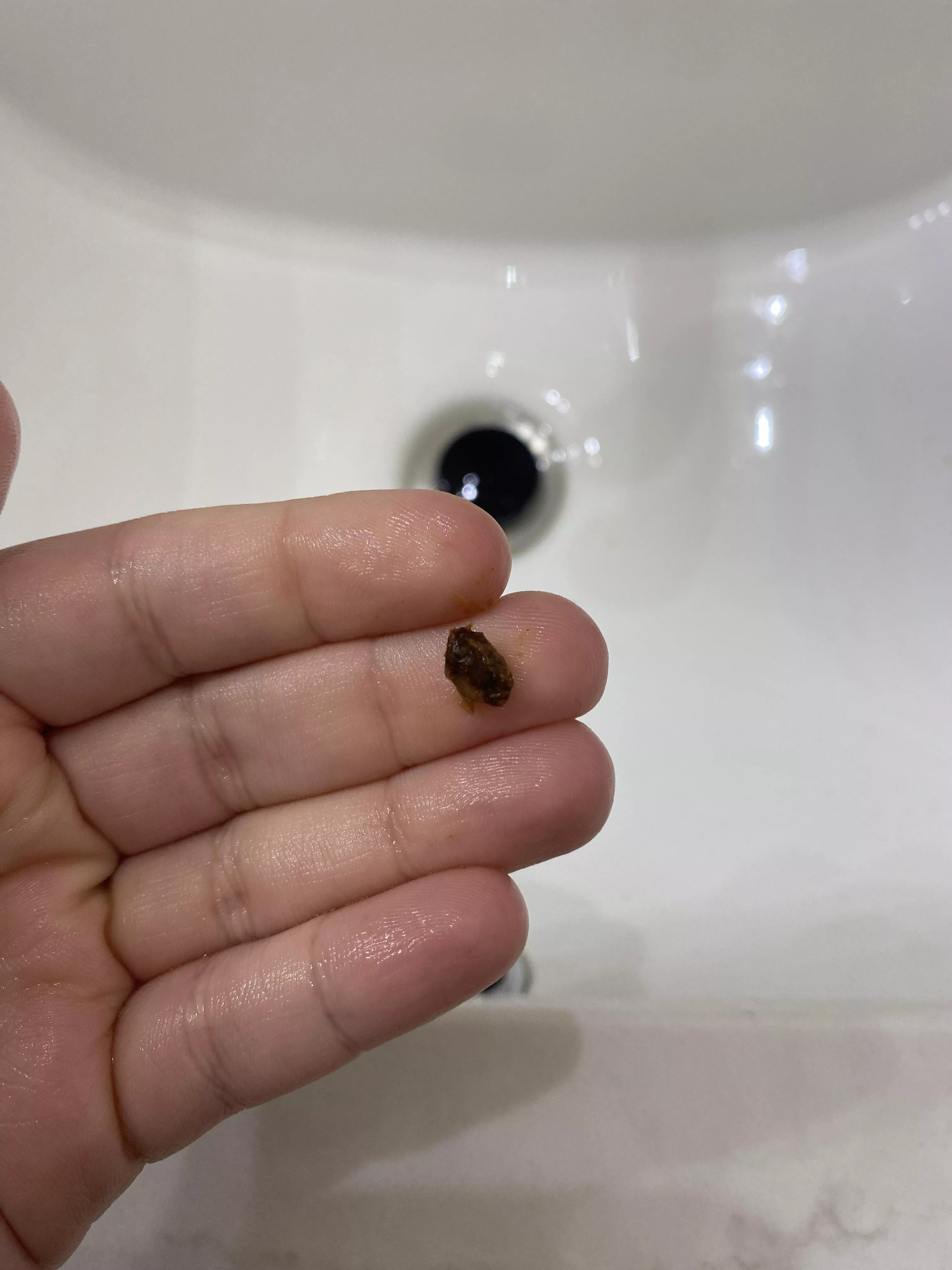 Spent all day feeling deaf until I got this out posted by Samara1010