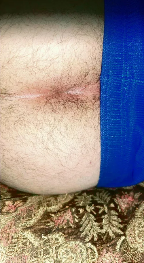 Lick my hairy butthole? by Patient-Strategy5887