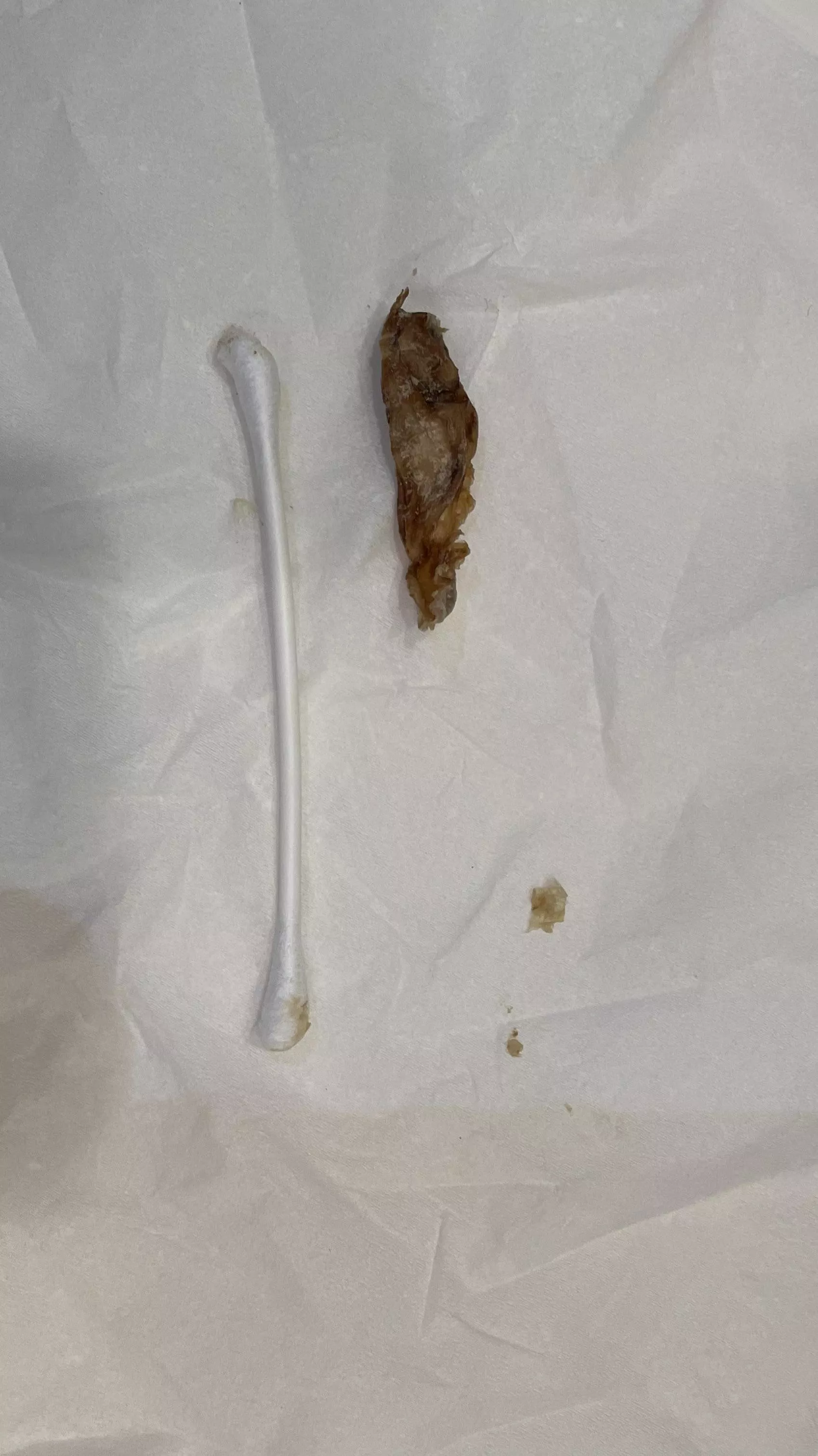 I have this taken out of my ear on a regular basis posted by foreverlost1nsea