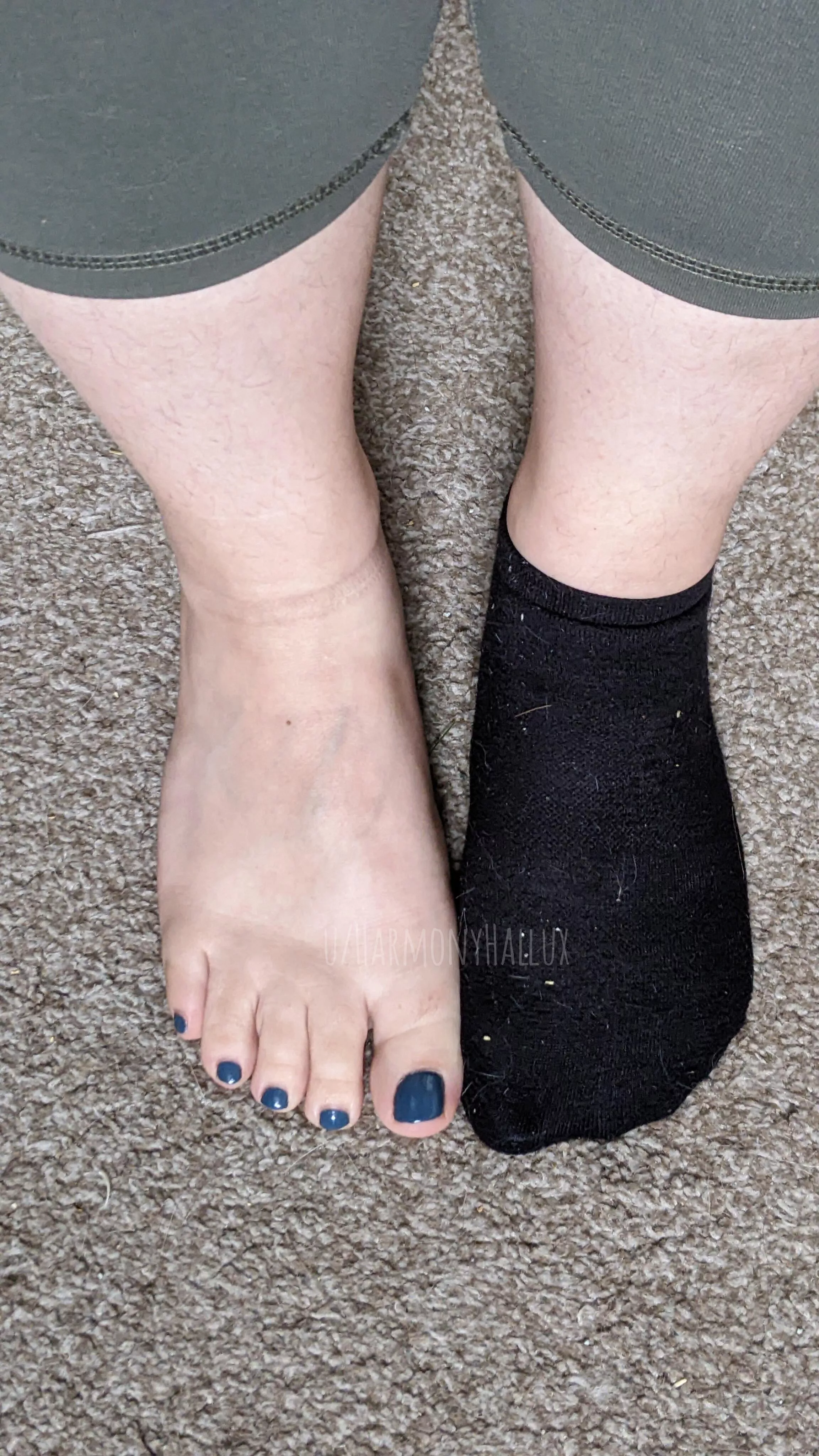 On Or Off? posted by HarmonyHallux