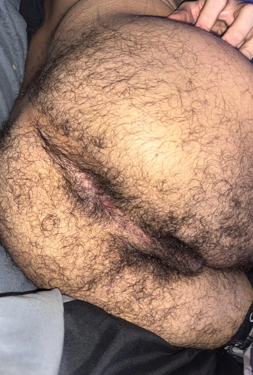 Am I too hairy for 19? posted by Valuable_Bend_6985