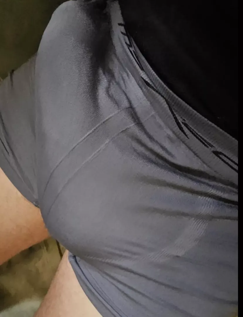 Felt bulgey today posted by ConnectTear9610