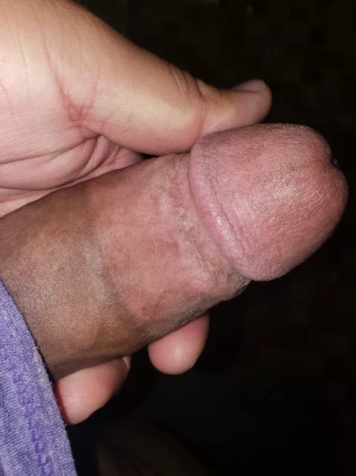 Anyone a fan of promenant scars? (28) by SuccessfulTap235