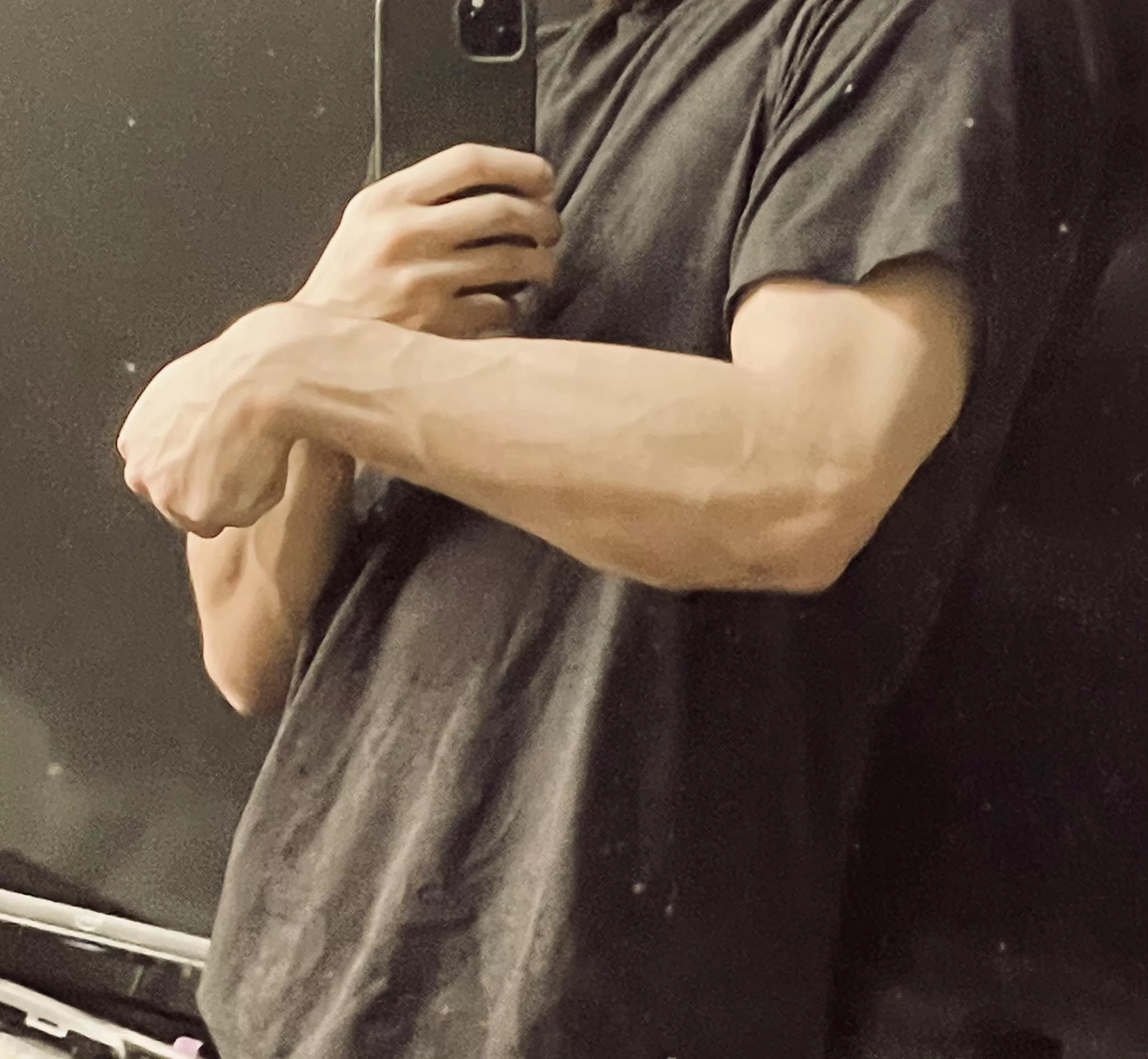 Forearm posted by SnooGiraffes2955