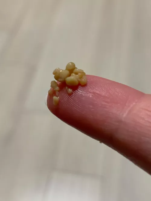 It just kept going and frankly, I’m a bit disgusted with myself. by unicorn_hair_core