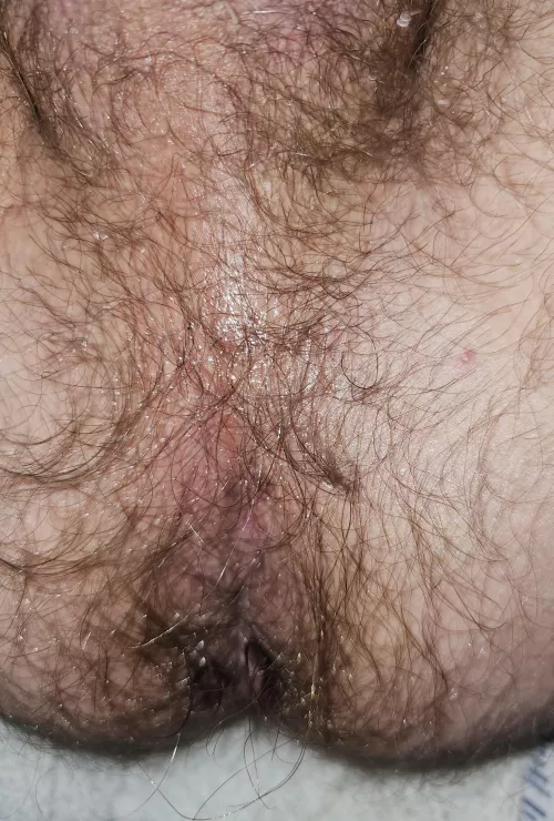My hairy hole by Sufficient-Score-618