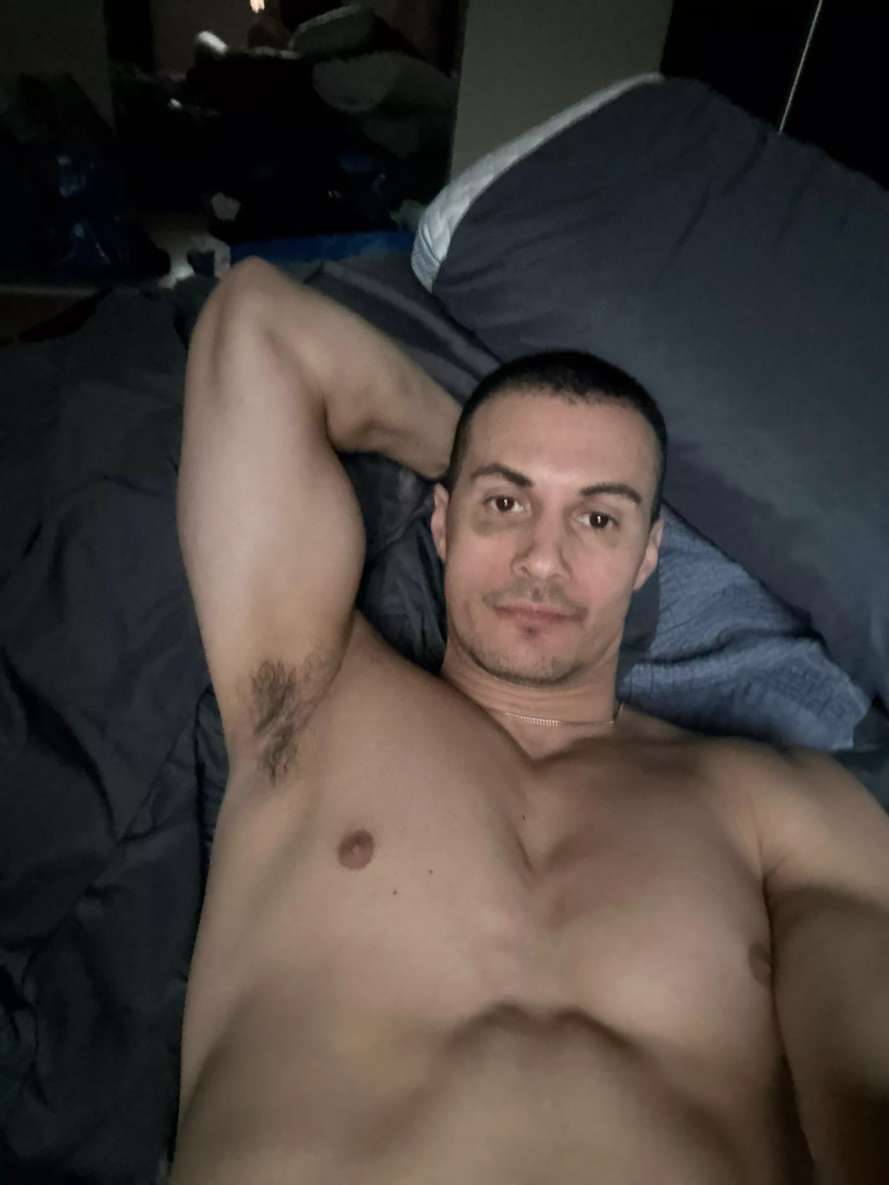 Pits and black eyes posted by MarsupialDiligent585