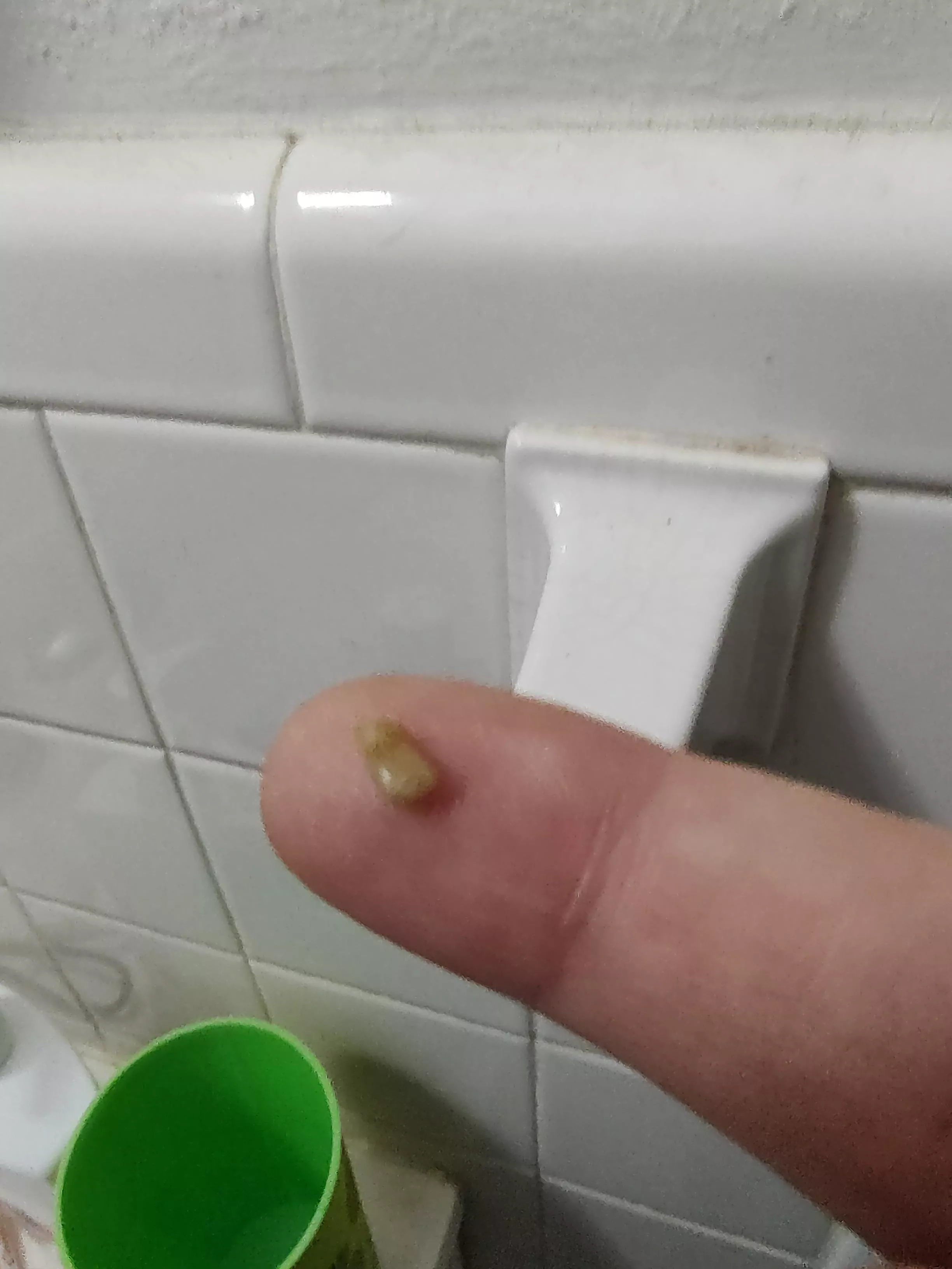 Woke up coughing up this bad boy posted by babyblazey