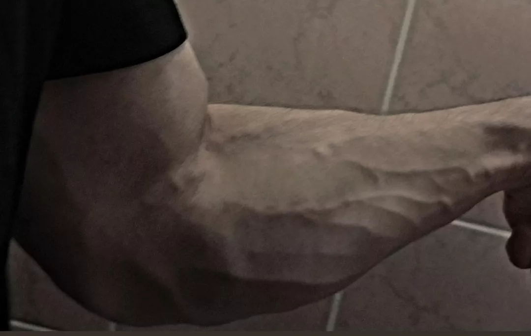 Does anybody like this much of veins in forearms posted by JackTheLegendary