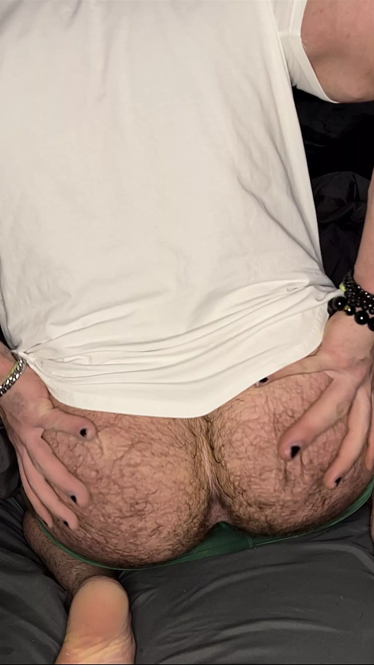 Too hairy? posted by Damiantheone96