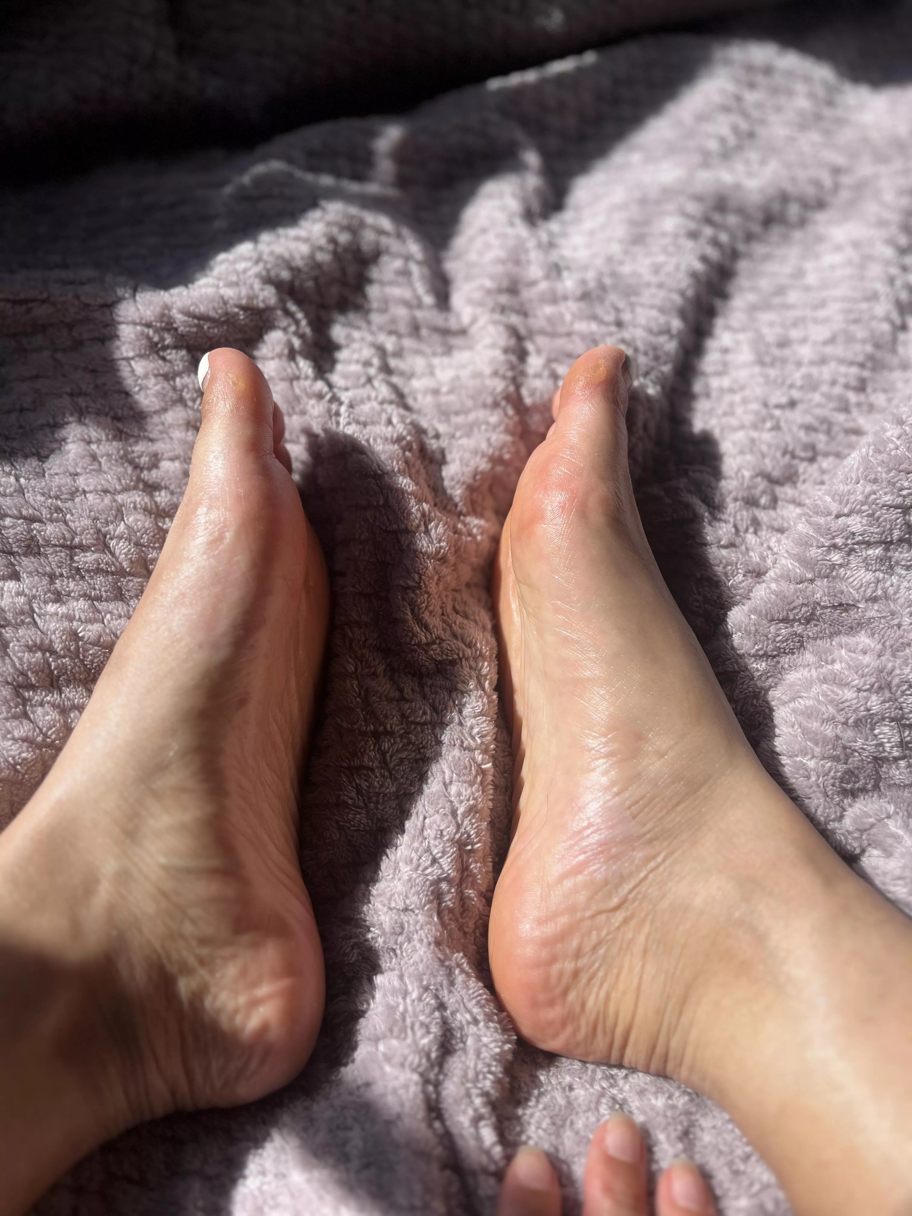 Need some vitamin D posted by xsavahge