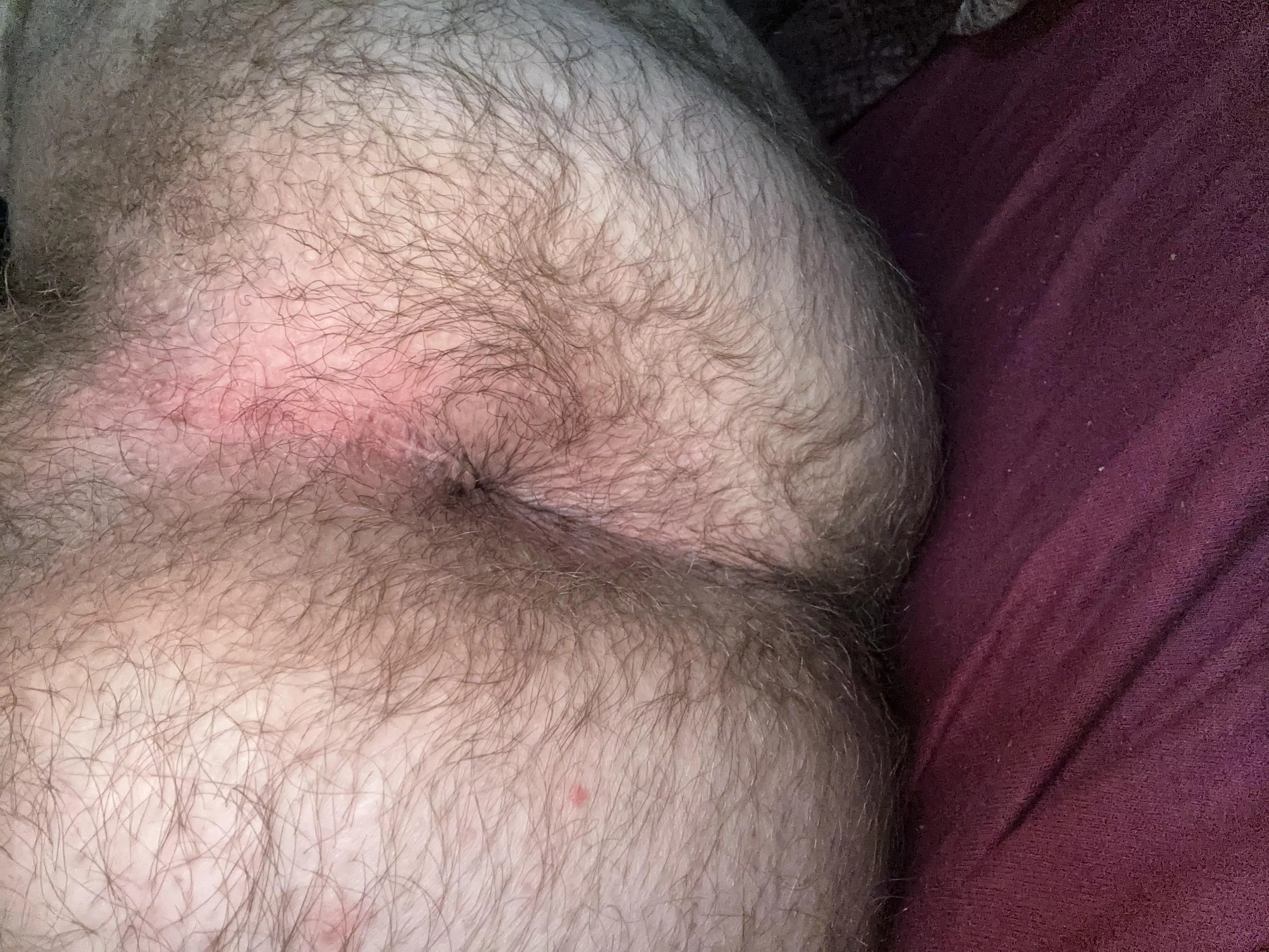 Should i shave? posted by AustrianBear_OF