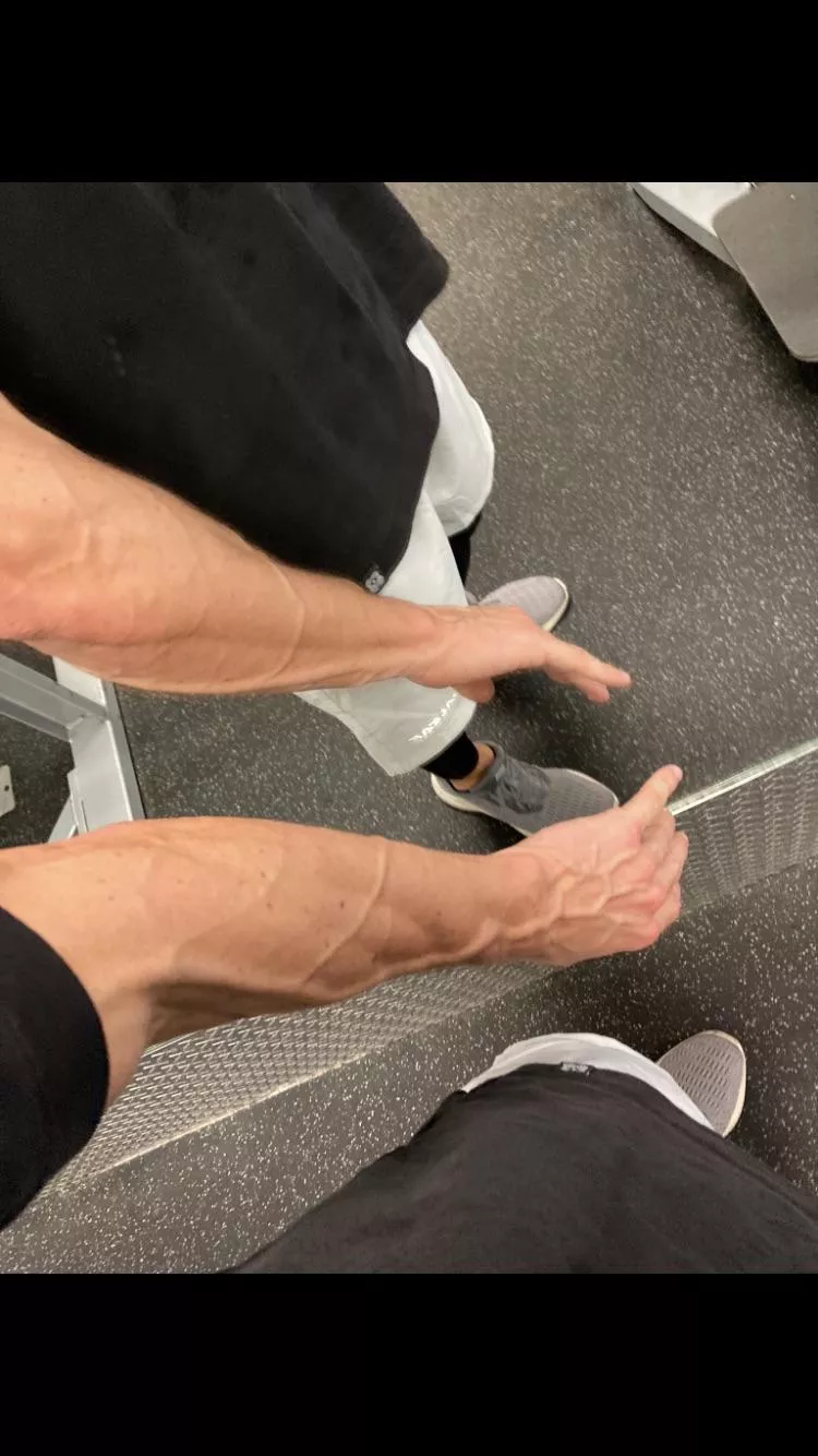 Just wanna share my gym forearm pump with you posted by Stupendous_Twig