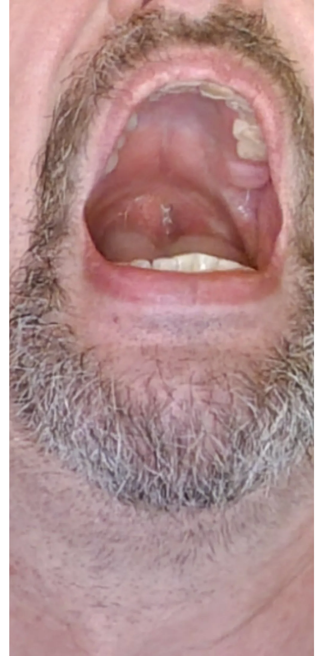 Cum in my whore mouth! posted by Loud_Combination_874