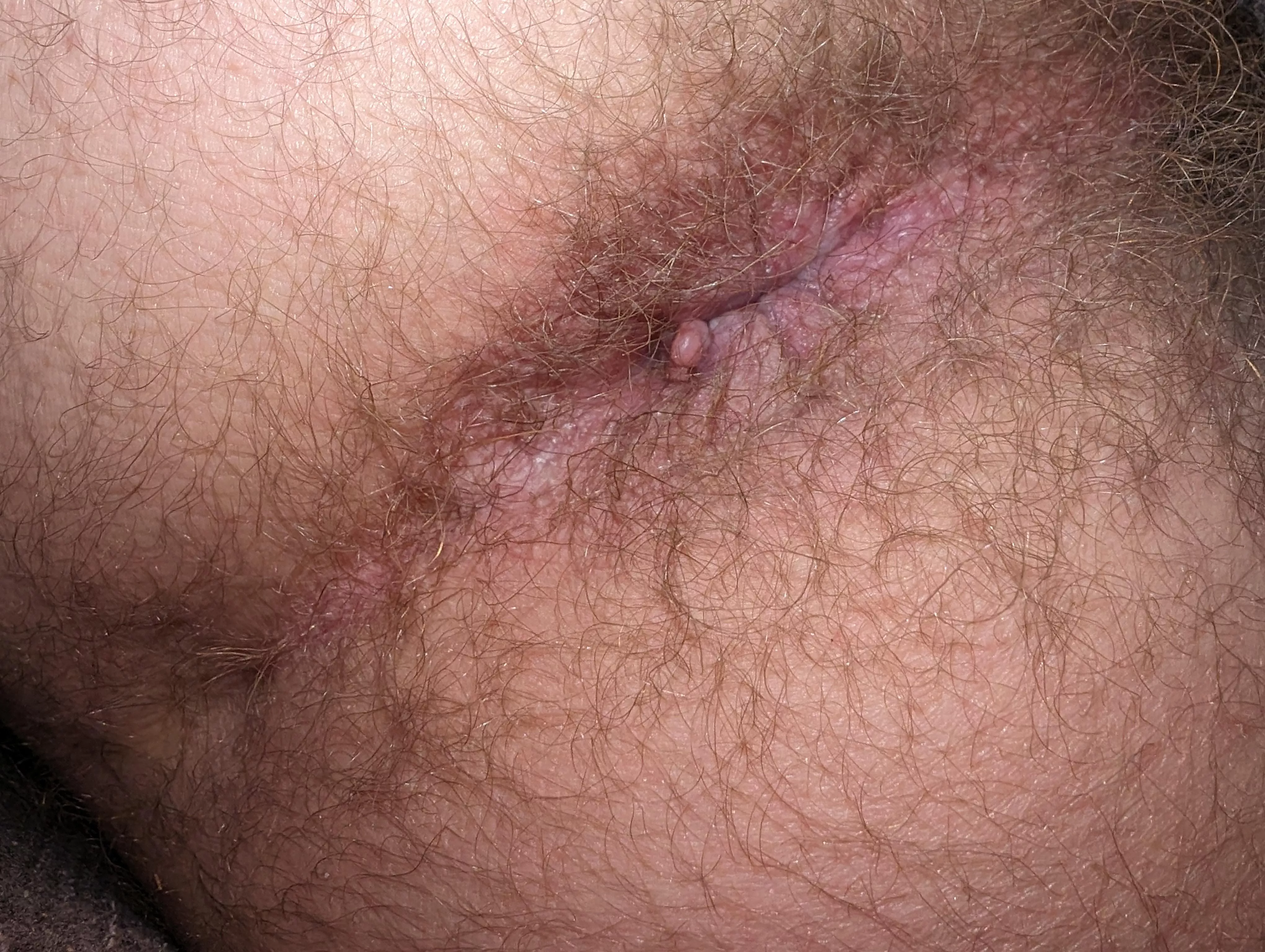 Hairy enough to eat? posted by responsive-banana