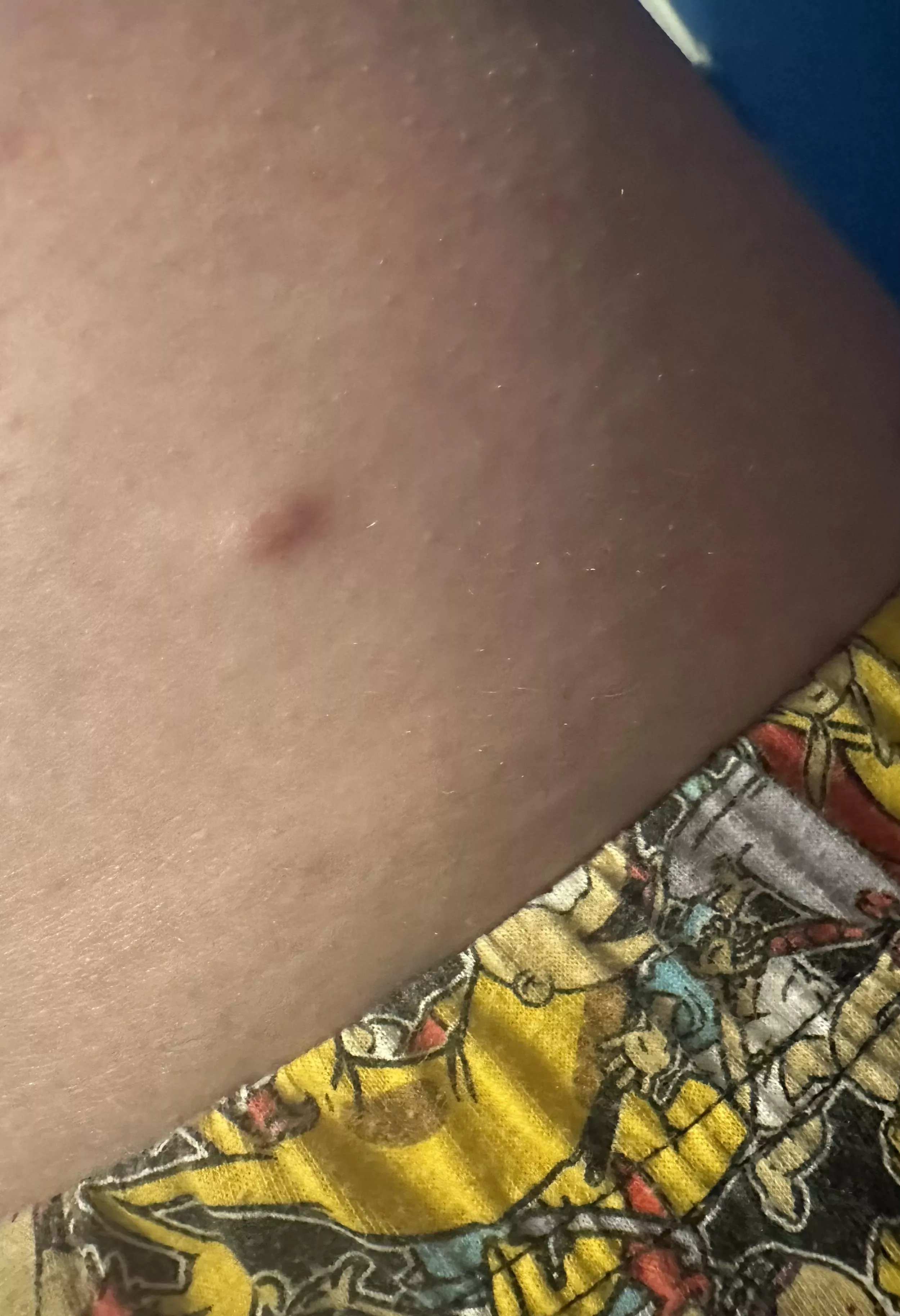 Has anyone else had something similar? posted by Jillianmarcoccia