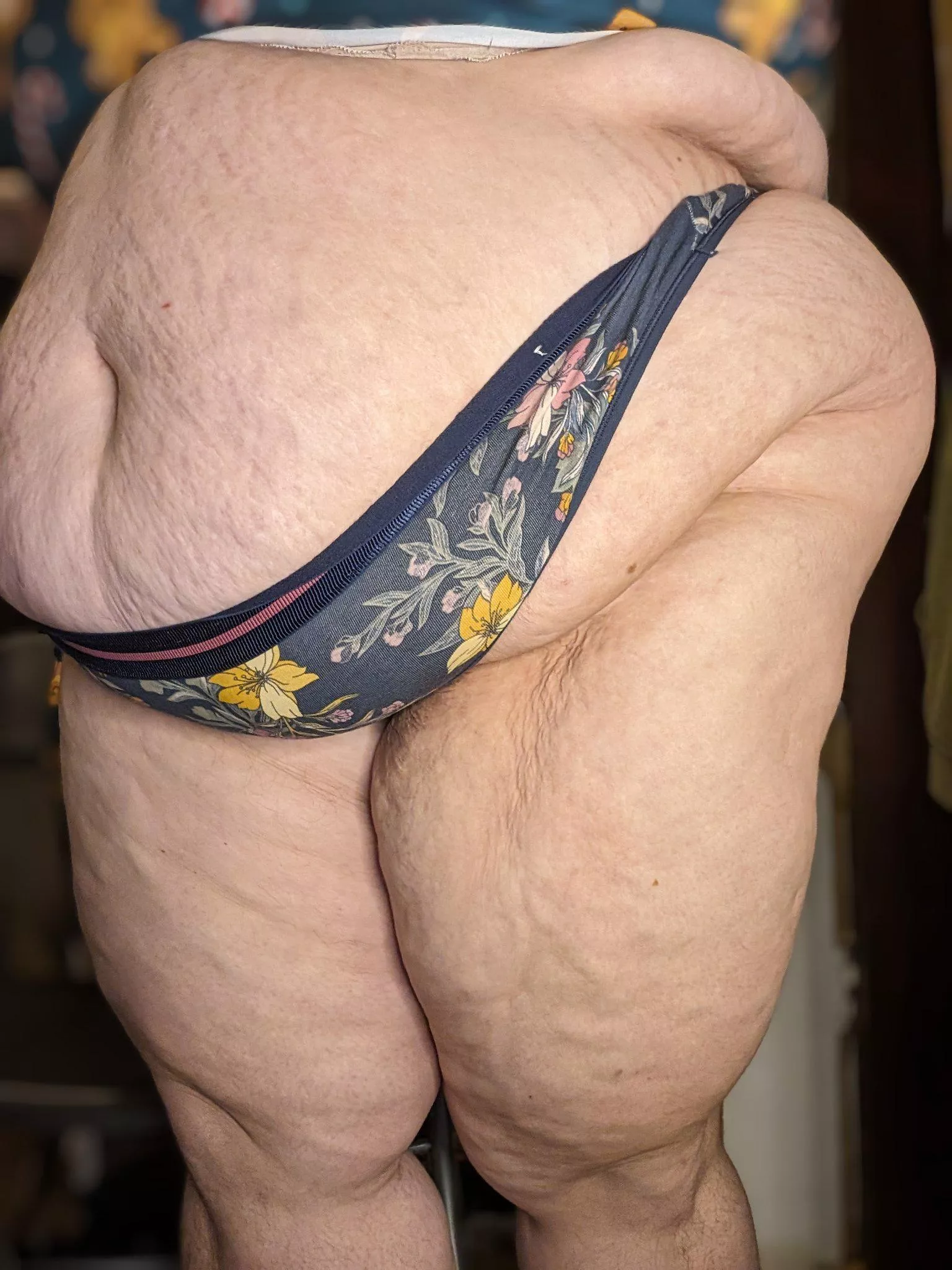 I love the way my fat folds posted by QueenJigglyPie