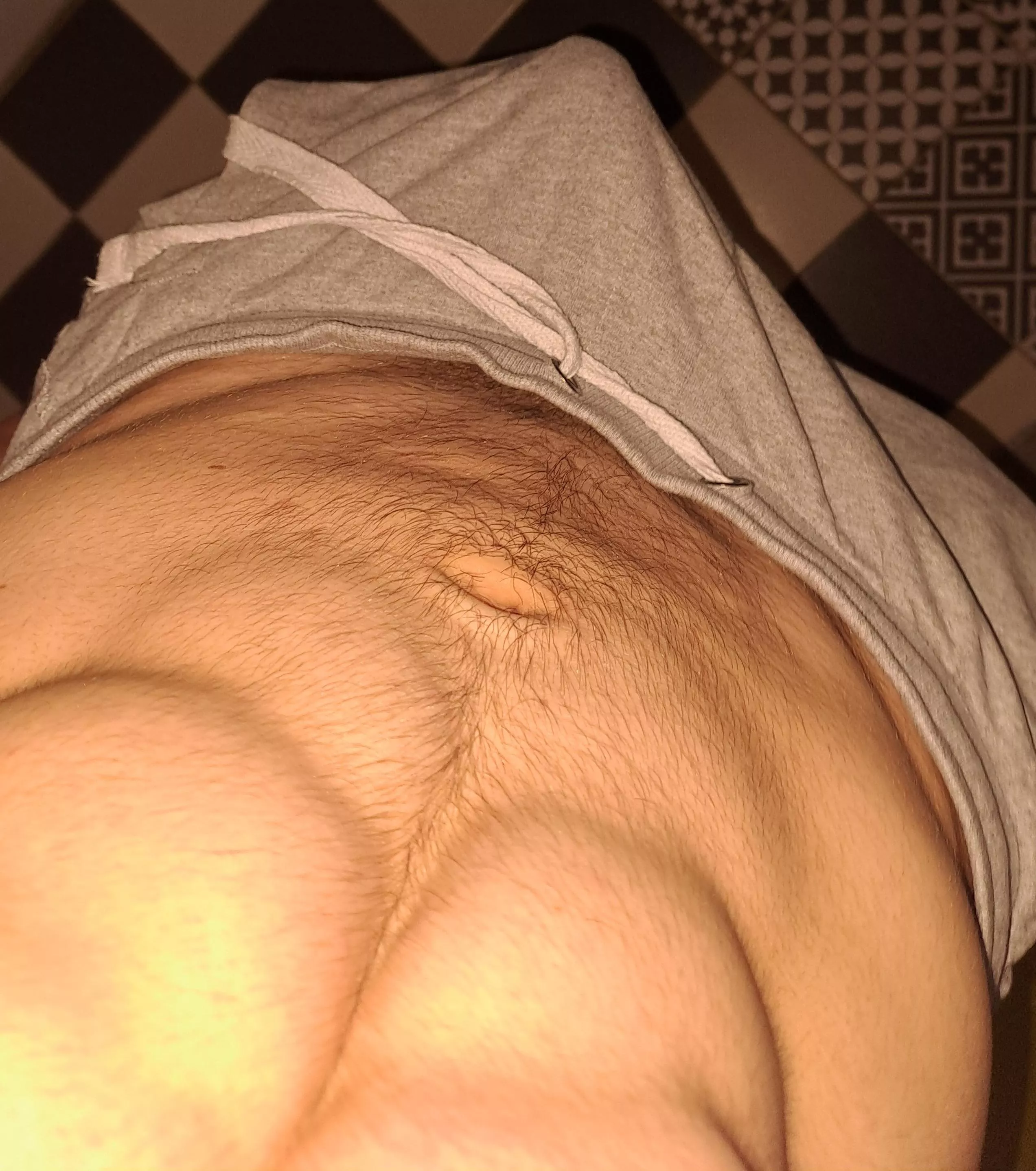 How am i supposed to go to work like this? posted by Additional_Photo_989