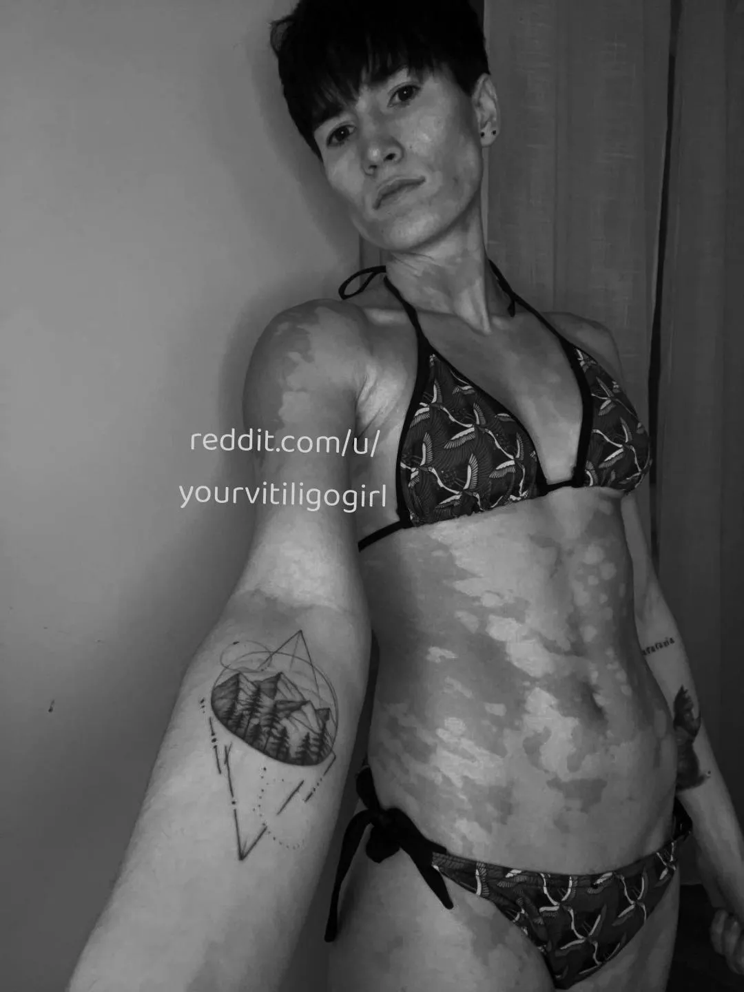 Going to get wet posted by yourvitiligogirl