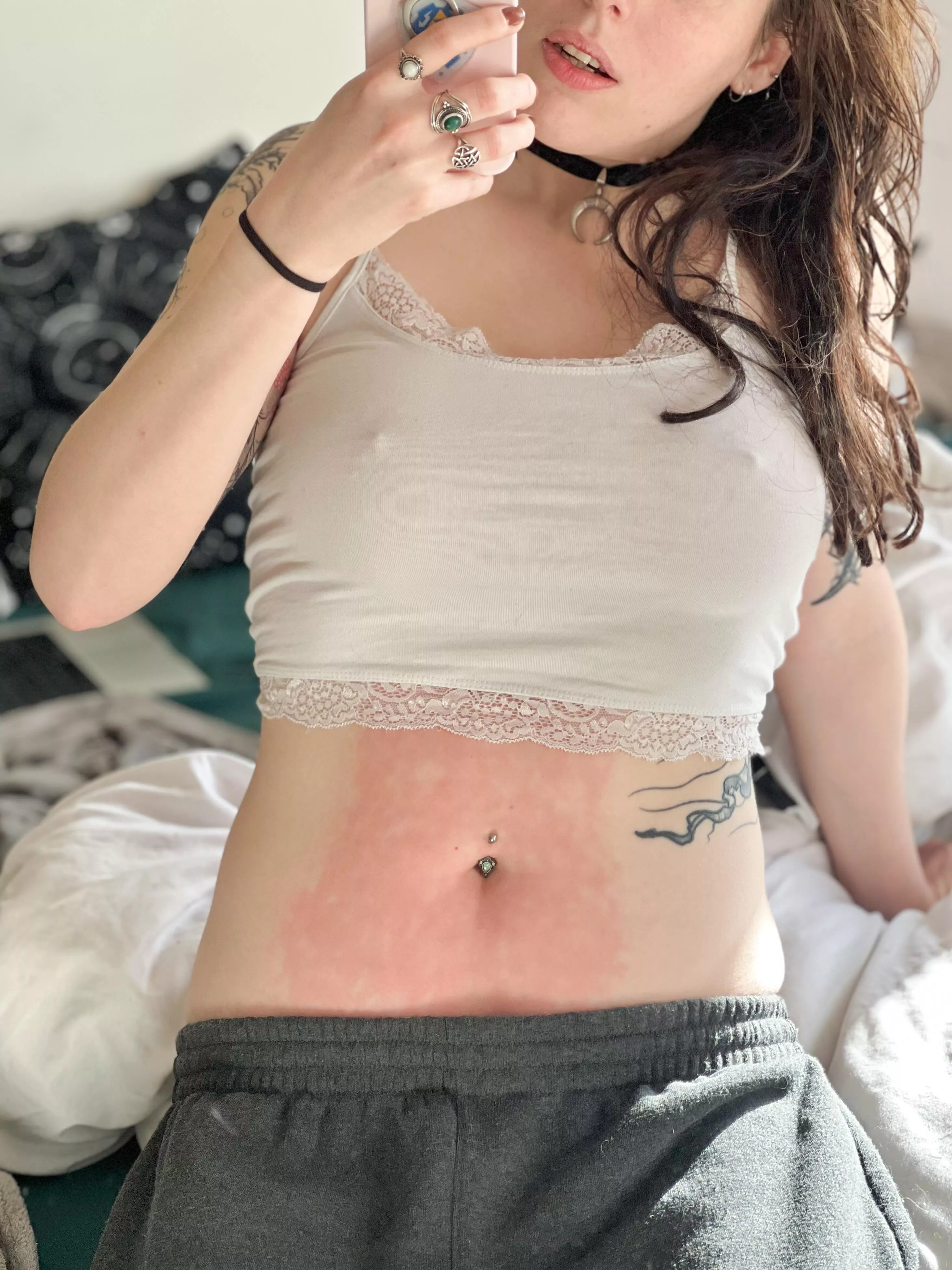 Lazy Sunday featuring hot water bottle burn marks posted by CandideCrush