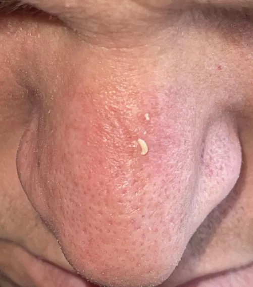 My husband’s nose is a gold mine by IntrovertedMUA