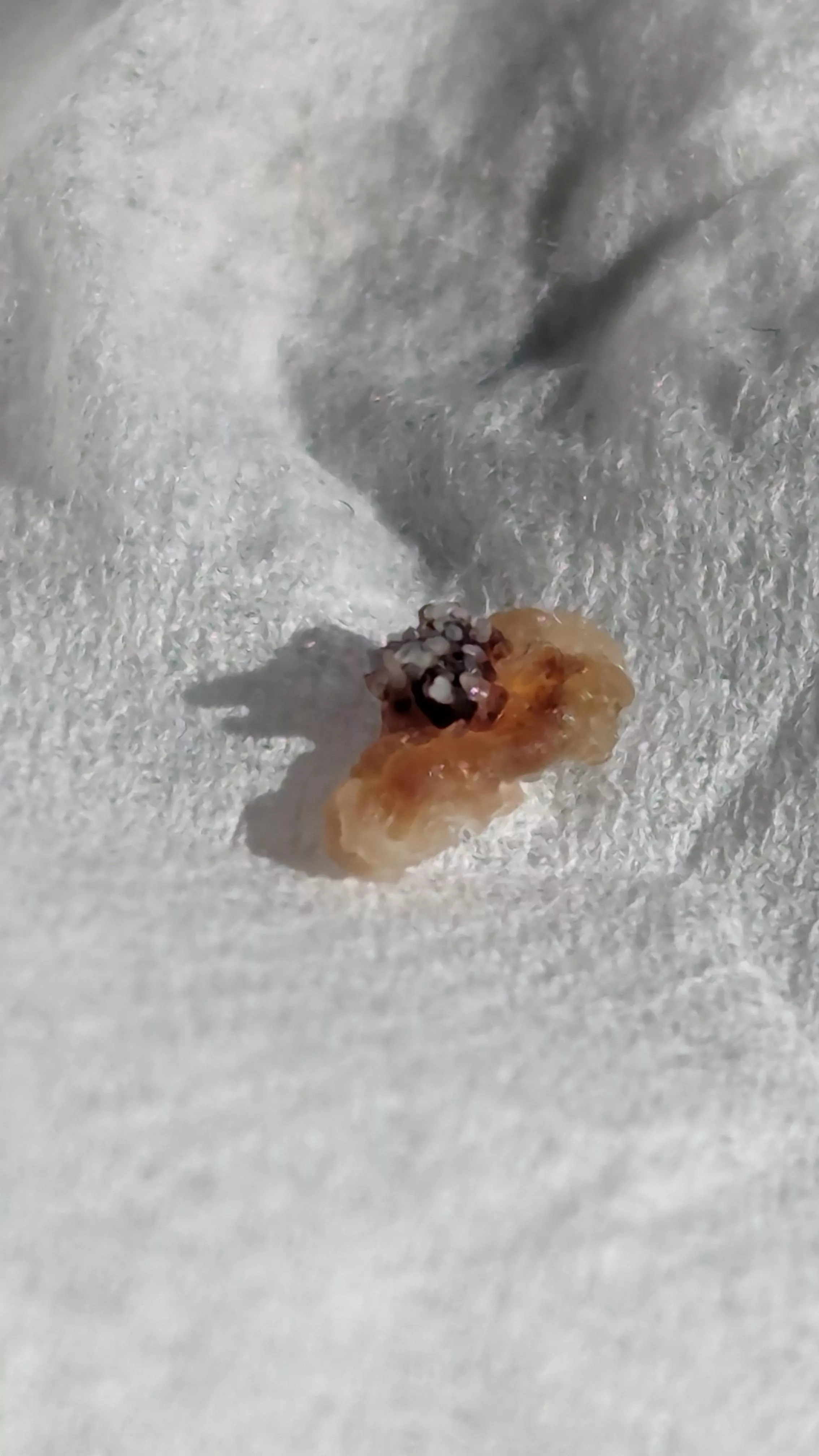 This wart that fell off my face after being frozen looks like a Nudibranch posted by BlazingCondor