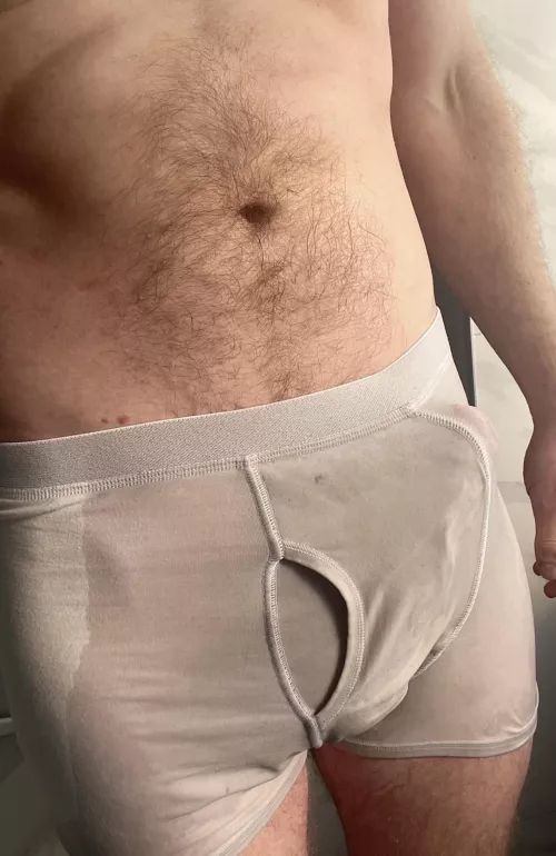 Accidents happen by ResponsibleSwitch6